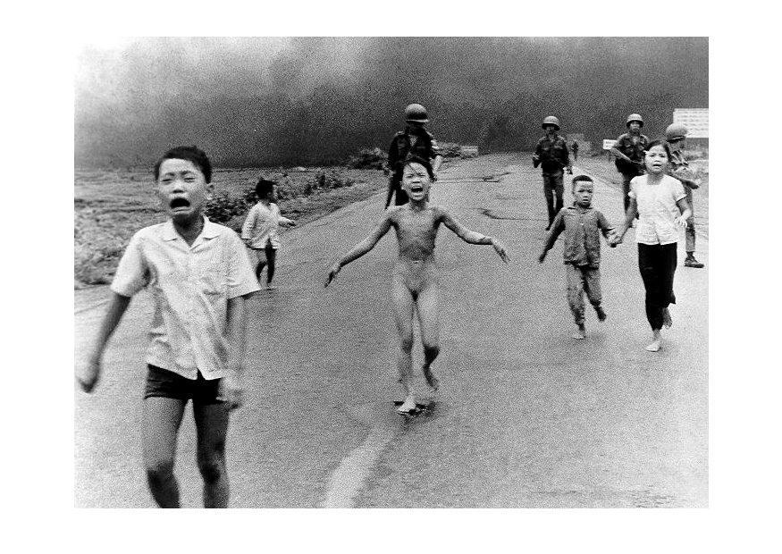 Foto bambini dopo attacco napalm